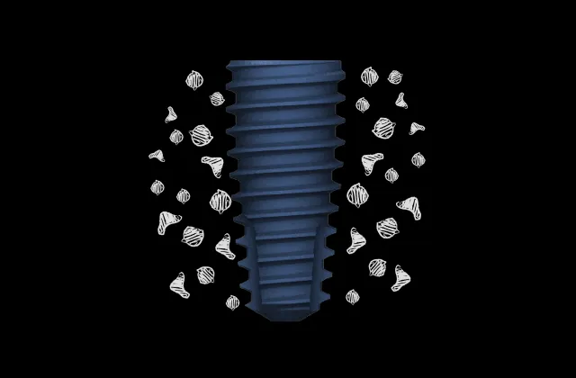 anyone regular thread type